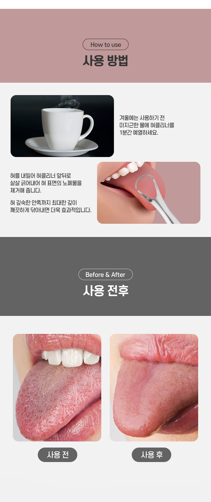 느낌상점 스텐 혀 크리너 입안백태 속에서 올라오는/혀클리너/혀백태제거/혓바닥백태/혀백태/백태제거/설태